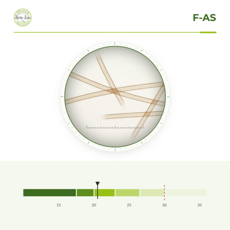 Simple fibre analysis